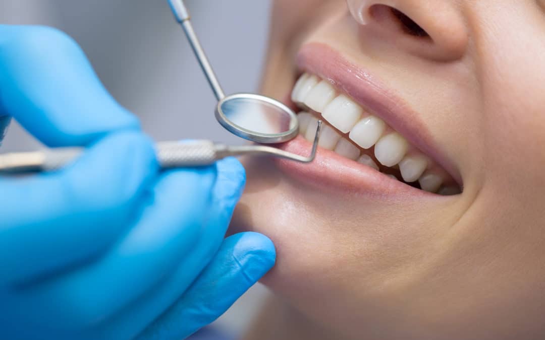 5 Questions to Ask When Choosing a Cherry Creek Dentist